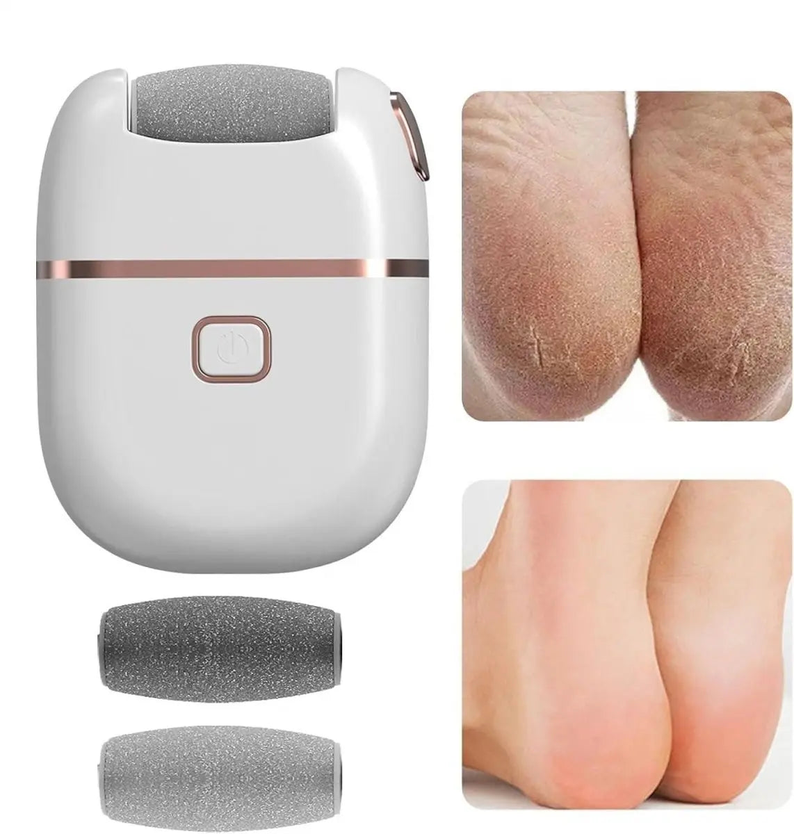 Electronic Pedicure Tool - CrazySuperStore